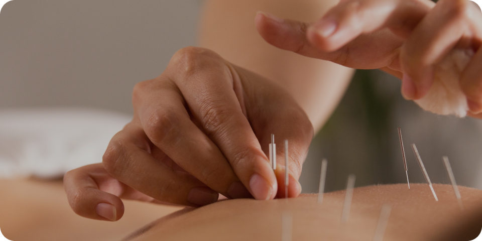 鍼灸