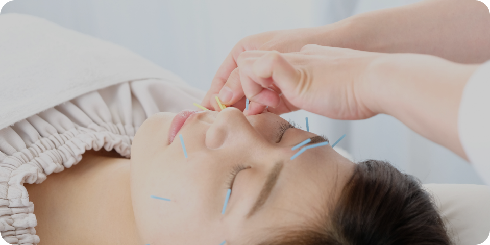 美容鍼